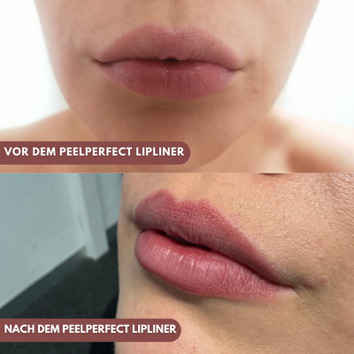 PeelPerfect™ Lipliner-Tattoo | Das Original